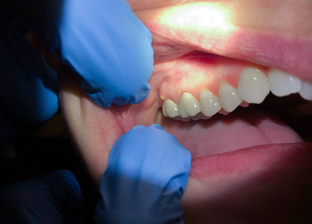 Best Emergency Gum Pain Relief  in Enid, OK